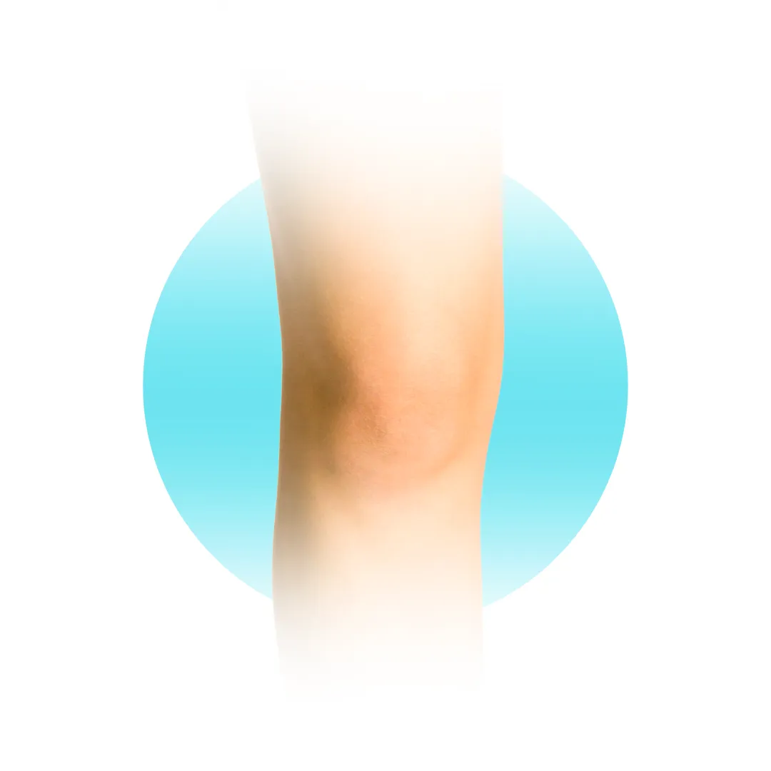 Knie