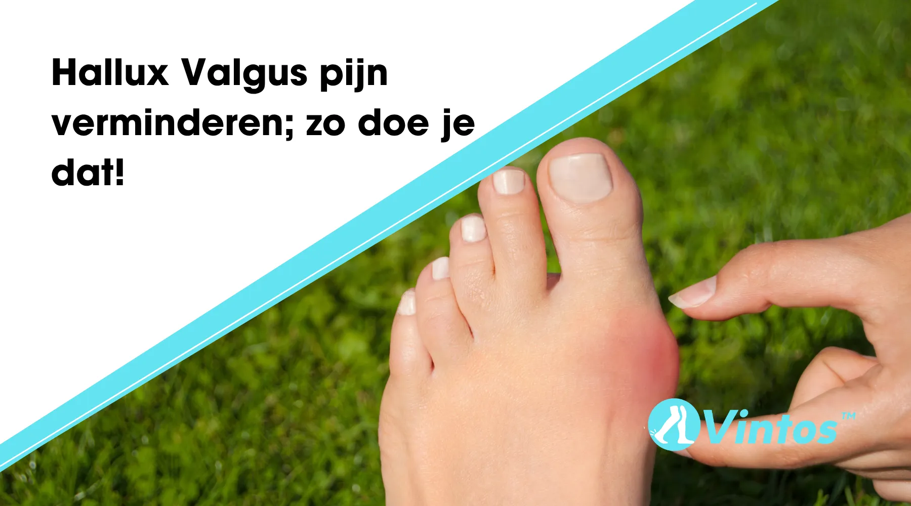 Hallux Valgus pijn verminderen